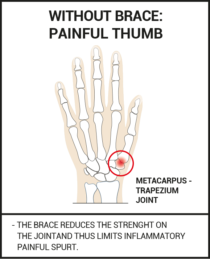 Epitact Flexible Thumb Brace Day - Left Hand - McCabes Pharmacy