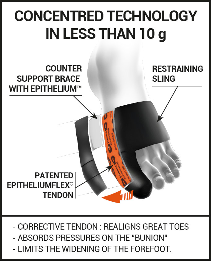 Sport bunion corrector, flexible & technical bunion support Epitact