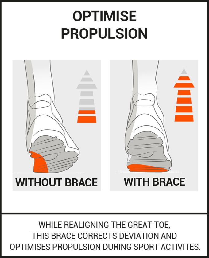 Sport bunion corrector, flexible & technical bunion support Epitact