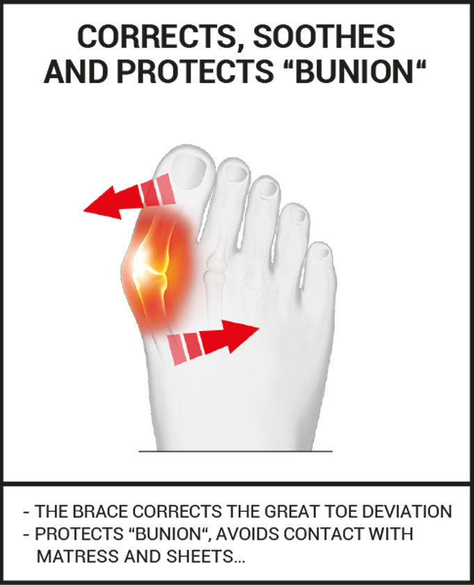 Night bunion corrector big toe straightener, bunion splint Epitact
