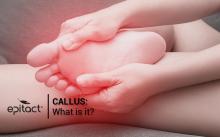 What is a foot callus?