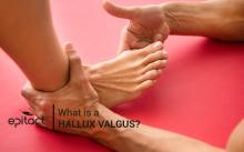 What is a bunion or hallux valgus?