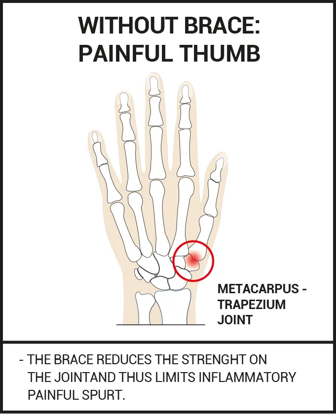 Thumb brace arthritis