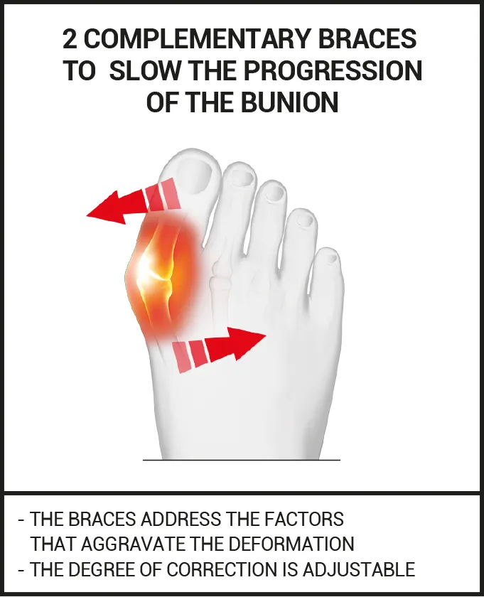 day and night bunion straighteners 