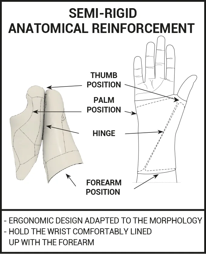 Carpal tunnel syndrome