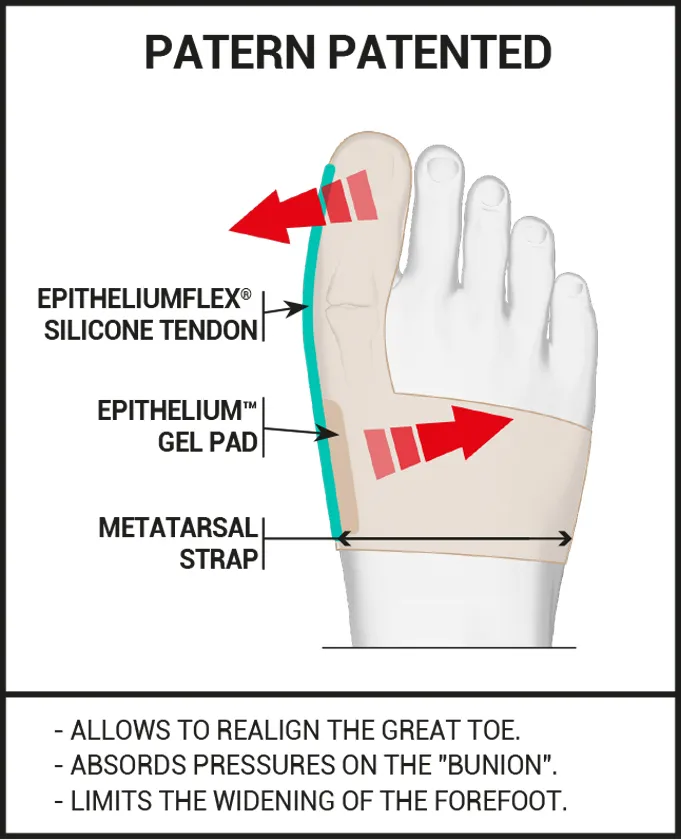 Hallux valgus Corrective brace