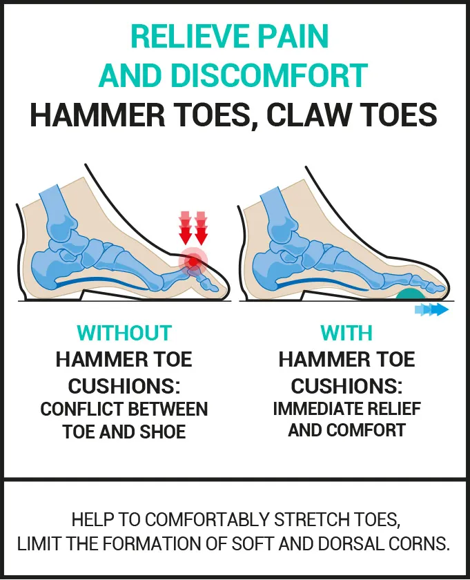 hammer toe cushions epitact