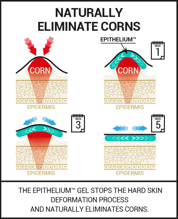hard and soft corn removal protections