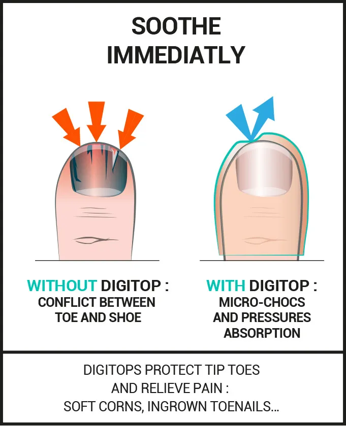 gel protections for toes epitact