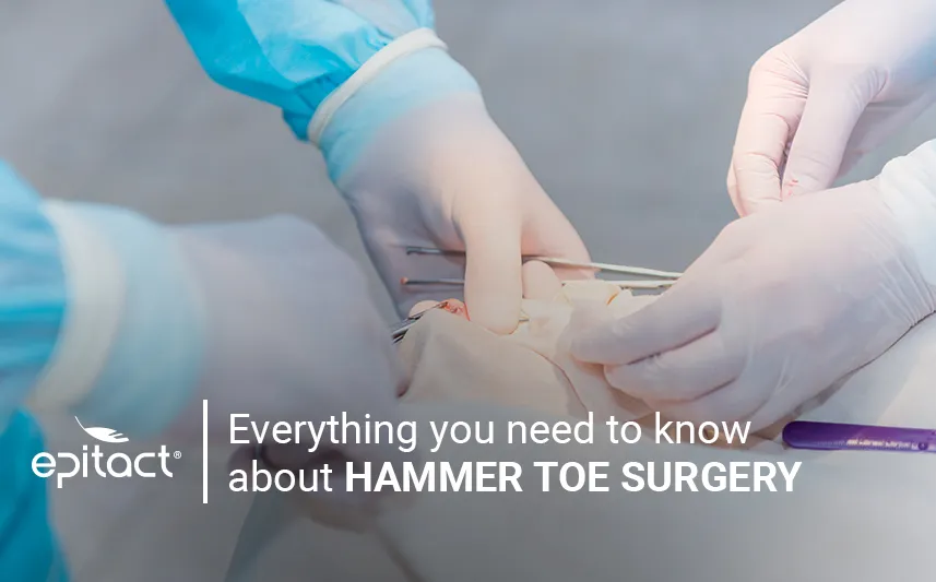 Claw and hammer toe surgery: procedure, recovery
