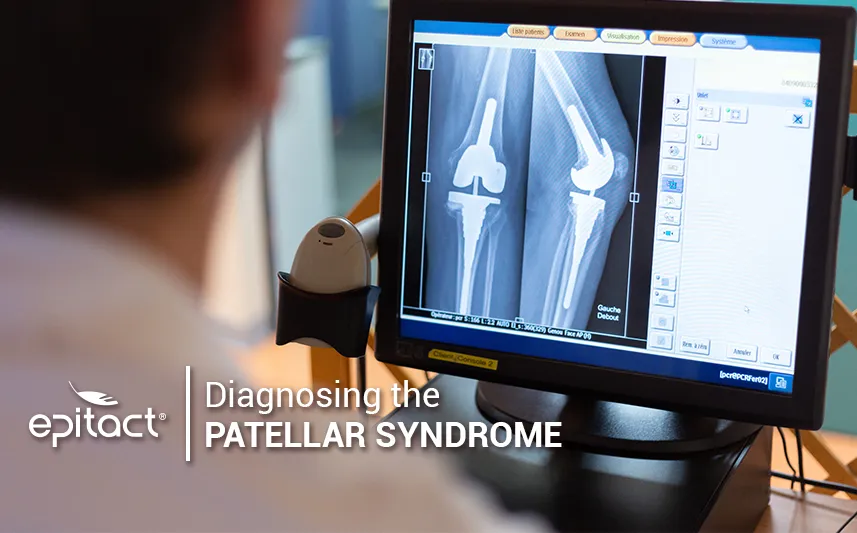 patellofemoral pain syndrome diagnosis